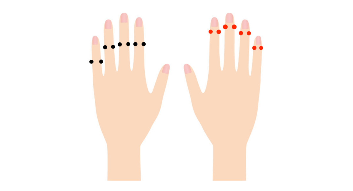 へバーデン結節ブシャール結節