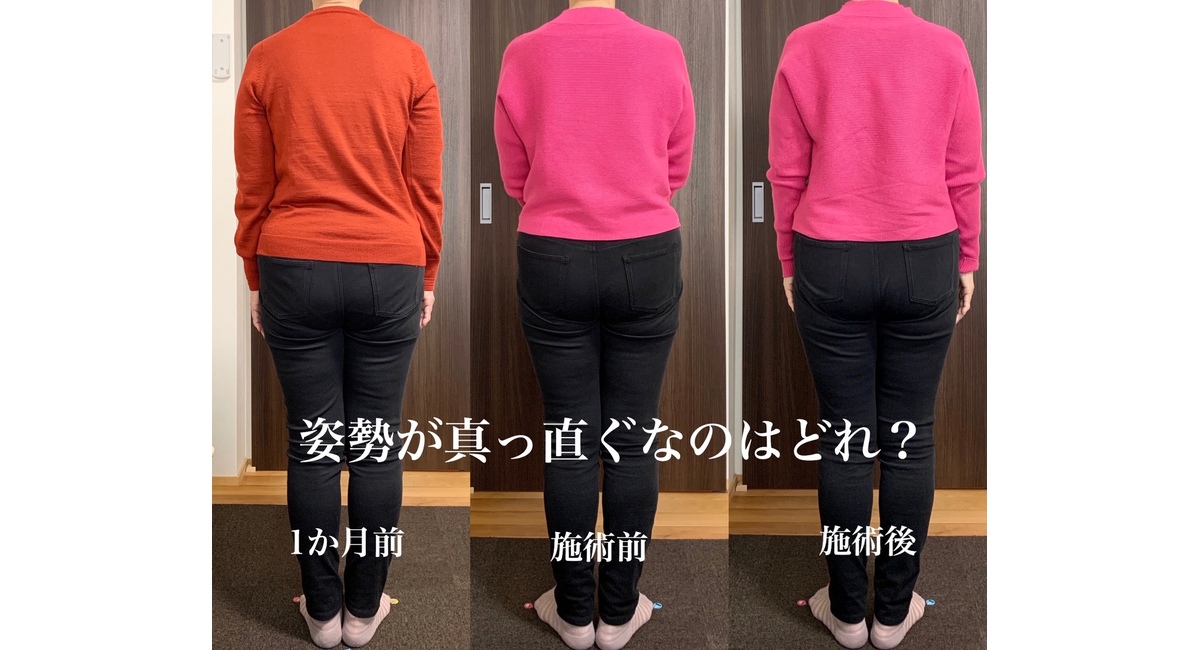 首こり・肩こり